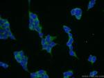 CYP7B1 Antibody in Immunocytochemistry (ICC/IF)