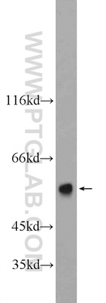 CYP7B1 Antibody in Western Blot (WB)