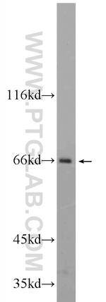 EVI2B Antibody in Western Blot (WB)