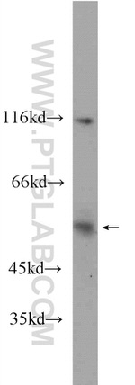 CCT2 Antibody in Western Blot (WB)