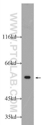 CCT2 Antibody in Western Blot (WB)