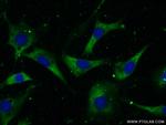 CCT2 Antibody in Immunocytochemistry (ICC/IF)