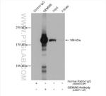 GEMIN5 Antibody in Immunoprecipitation (IP)