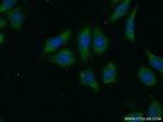 LRP5 Antibody in Immunocytochemistry (ICC/IF)