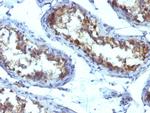 Alkaline Phosphatase (Tissue-Nonspecific) Antibody in Immunohistochemistry (Paraffin) (IHC (P))