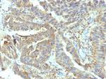 Alkaline Phosphatase (Tissue-Nonspecific) Antibody in Immunohistochemistry (Paraffin) (IHC (P))