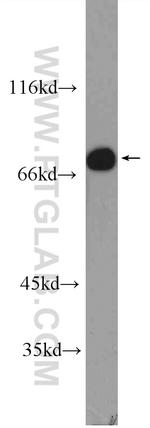 SLC22A23 Antibody in Western Blot (WB)