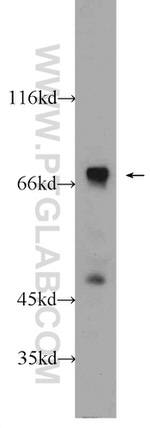 SLC22A23 Antibody in Western Blot (WB)