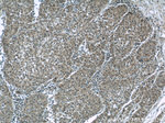 HDAC10 Antibody in Immunohistochemistry (Paraffin) (IHC (P))