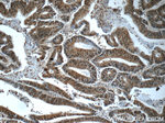 HDAC10 Antibody in Immunohistochemistry (Paraffin) (IHC (P))