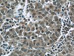 HDAC10 Antibody in Immunohistochemistry (Paraffin) (IHC (P))