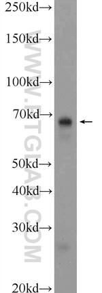 HDAC10 Antibody in Western Blot (WB)