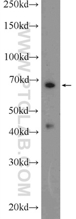 HDAC10 Antibody in Western Blot (WB)