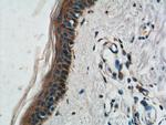 ST8SIA1 Antibody in Immunohistochemistry (Paraffin) (IHC (P))