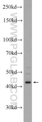 ST8SIA1 Antibody in Western Blot (WB)