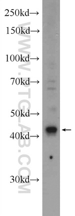 ST8SIA1 Antibody in Western Blot (WB)