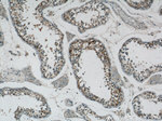 DHX35 Antibody in Immunohistochemistry (Paraffin) (IHC (P))