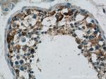 DHX35 Antibody in Immunohistochemistry (Paraffin) (IHC (P))