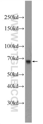 DHX35 Antibody in Western Blot (WB)