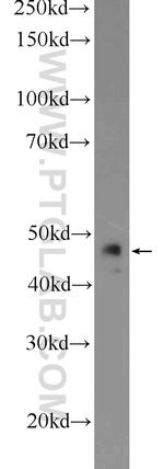 ST3GAL3 Antibody in Western Blot (WB)