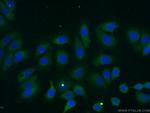 ILK Antibody in Immunocytochemistry (ICC/IF)