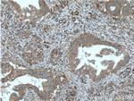 ILK Antibody in Immunohistochemistry (Paraffin) (IHC (P))