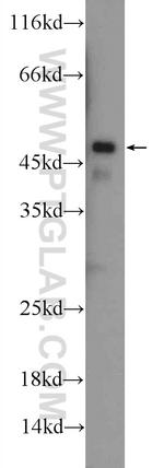 ILK Antibody in Western Blot (WB)