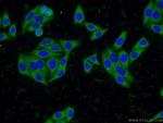 SCCPDH Antibody in Immunocytochemistry (ICC/IF)