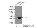 SCCPDH Antibody in Immunoprecipitation (IP)