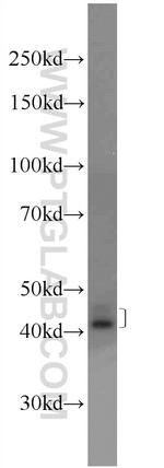 SCCPDH Antibody in Western Blot (WB)