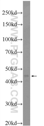 SCCPDH Antibody in Western Blot (WB)