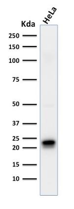 Ferritin, Heavy Chain (FTH) Antibody in Western Blot (WB)