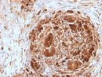 Ferritin, Heavy Chain (FTH) Antibody in Immunohistochemistry (Paraffin) (IHC (P))