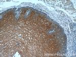 LCE1A Antibody in Immunohistochemistry (Paraffin) (IHC (P))