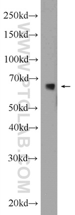 C6orf182 Antibody in Western Blot (WB)