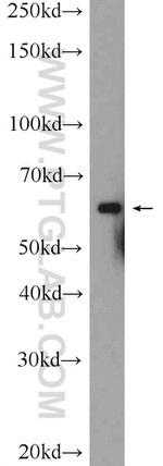 C6orf182 Antibody in Western Blot (WB)