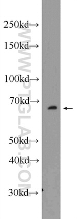 C6orf182 Antibody in Western Blot (WB)