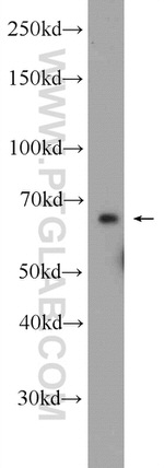 C6orf182 Antibody in Western Blot (WB)