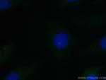 C6orf182 Antibody in Immunocytochemistry (ICC/IF)