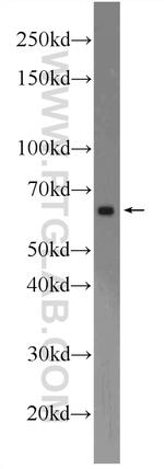 C6orf182 Antibody in Western Blot (WB)