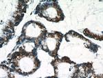 C18orf21 Antibody in Immunohistochemistry (Paraffin) (IHC (P))