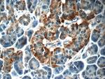 C18orf21 Antibody in Immunohistochemistry (Paraffin) (IHC (P))