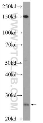 C18orf21 Antibody in Western Blot (WB)