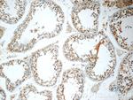 FDXACB1 Antibody in Immunohistochemistry (Paraffin) (IHC (P))