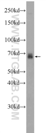 FDXACB1 Antibody in Western Blot (WB)