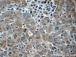 KHDC3L Antibody in Immunohistochemistry (Paraffin) (IHC (P))