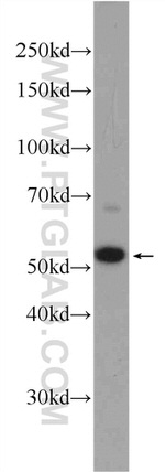 ZC3H12D Antibody in Western Blot (WB)