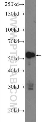 ZC3H12D Antibody in Western Blot (WB)