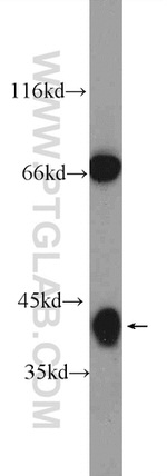 HuD Antibody in Western Blot (WB)