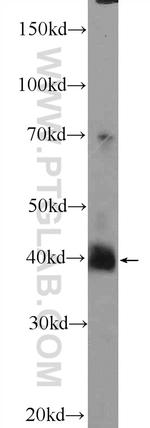 HuD Antibody in Western Blot (WB)